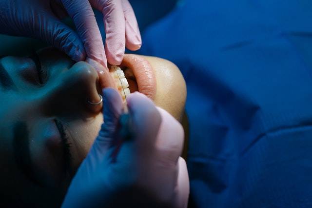 Orthodontic Treatment