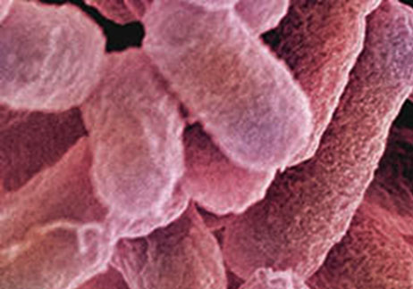 E.coli
