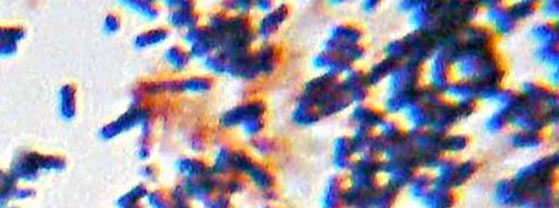 helpful bacteria